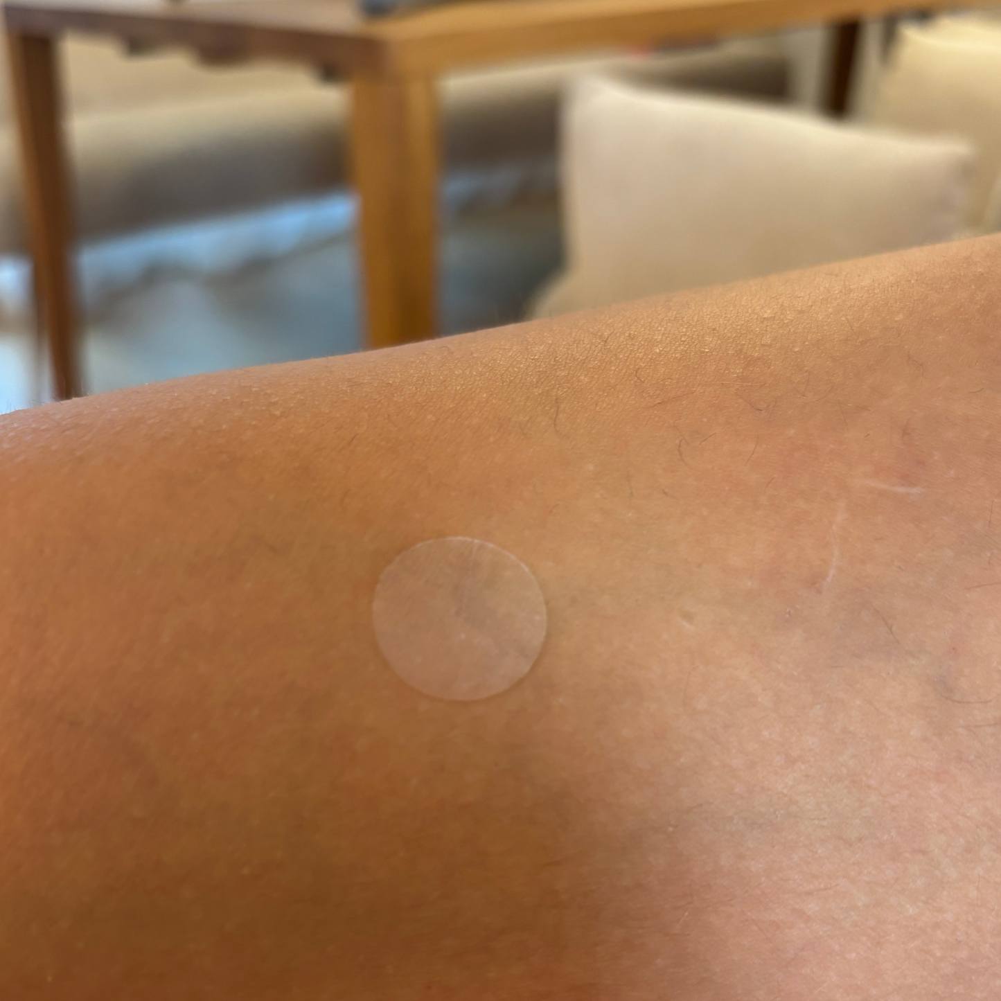 Mosquito Loop Mückenstich Patches